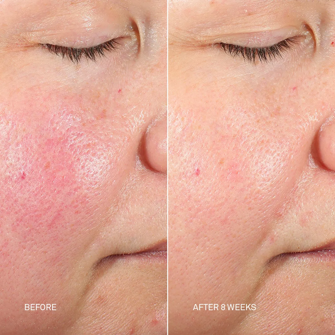 DNA Repair Complex PRO 120mL - the Ultimate Skin Damage   Scar Treatment Solution