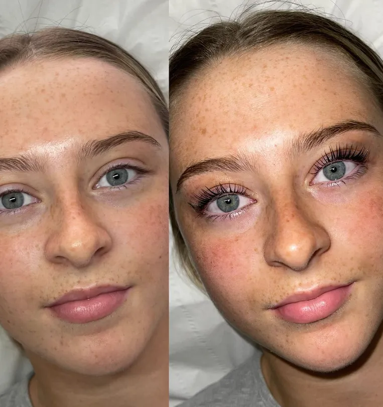 Lash Bomb Pack (Step 1 & 2)